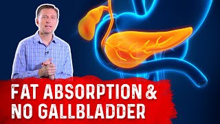 What Happens to Fat Absorption With NO Gallbladder – Dr Berg [upl. by Windham]