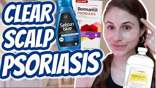 How to CLEAR SCALP PSORIASIS Dr Dray [upl. by Fleisher730]