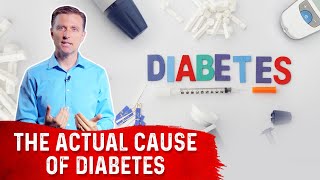 The Underlying Cause Of Diabetes – DrBerg [upl. by Dal]